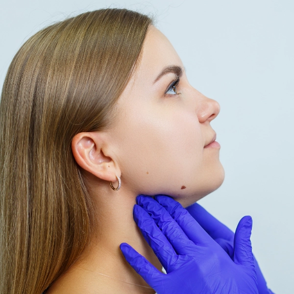 servicio mentoplastia